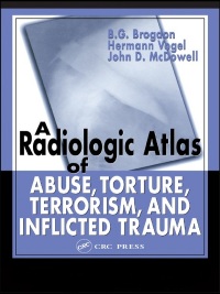 Titelbild: A Radiologic Atlas of Abuse, Torture, Terrorism, and Inflicted Trauma 1st edition 9780849315336