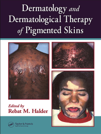 Cover image: Dermatology and Dermatological Therapy of Pigmented Skins 1st edition 9780849314025