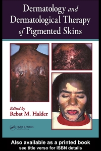 Cover image: Dermatology and Dermatological Therapy of Pigmented Skins 1st edition 9780849314025