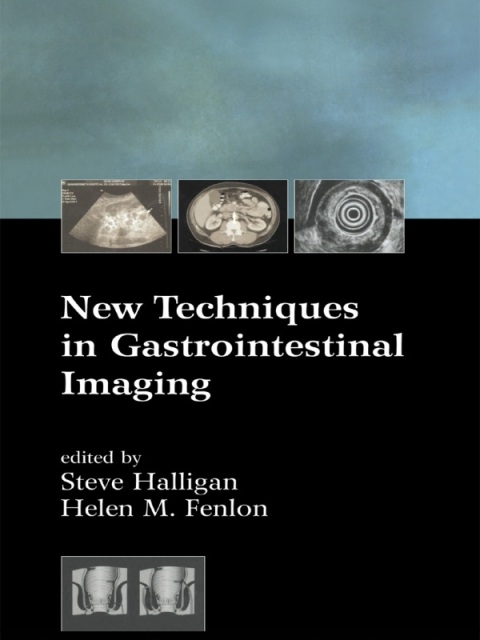 New Techniques in Gastrointestinal Imaging, 1st Edition - FULL INSTANT DOWNLOAD | PDF DOCX EPUB