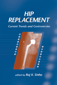 Cover image: Hip Replacement 1st edition 9780824707897