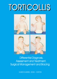 Cover image: Torticollis 1st edition 9780789003164