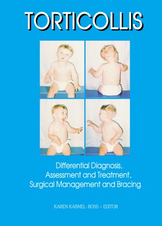 Cover image: Torticollis 1st edition 9780789003164