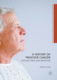 Cover image: A History of Prostate Cancer 9781349739387