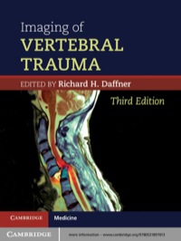 Cover image: Imaging of Vertebral Trauma 3rd edition 9780521897013