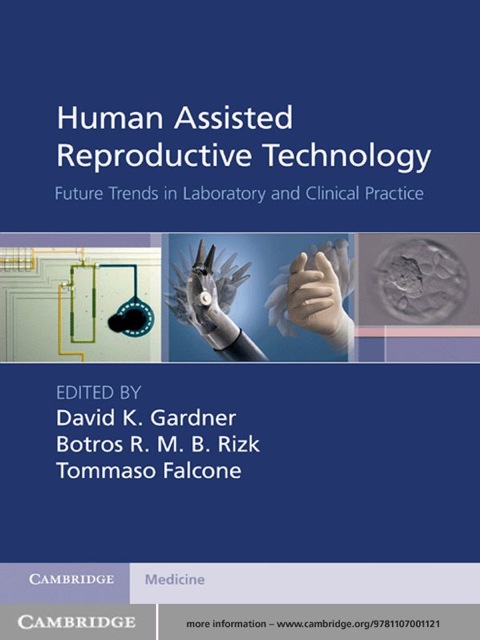 Human Assisted Reproductive Technology: Future Trends in Laboratory and Clinical Practice, 1st Edition - FULL INSTANT DOWNLOAD | PDF DOCX EPUB