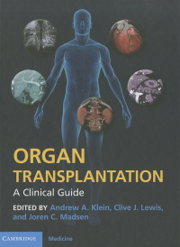 Cover image: Organ Transplantation 1st edition 9780521197533