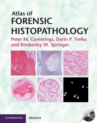 Cover image: Atlas of Forensic Histopathology 1st edition 9780521110891