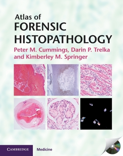 Atlas of Forensic Histopathology, 1st Edition - FULL INSTANT DOWNLOAD | PDF DOCX EPUB