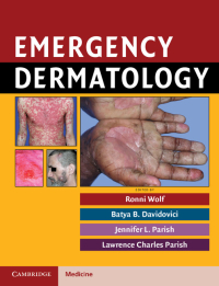 Cover image: Emergency Dermatology 1st edition 9780521717335