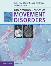 Cover image: Uncommon Causes of Movement Disorders 1st edition 9780521111546