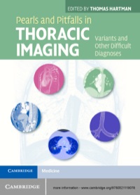Imagen de portada: Pearls and Pitfalls in Thoracic Imaging 1st edition 9780521119078
