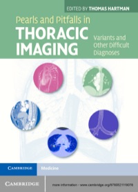 表紙画像: Pearls and Pitfalls in Thoracic Imaging 1st edition 9780521119078