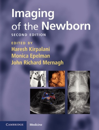 Cover image: Imaging of the Newborn 2nd edition 9780521896269