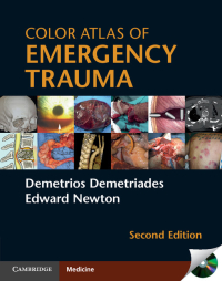 Cover image: Color Atlas of Emergency Trauma 2nd edition 9781107001527