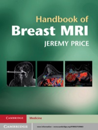Cover image: Handbook of Breast MRI 1st edition 9780521139663