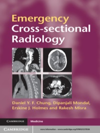 Cover image: Emergency Cross-sectional Radiology 1st edition 9780521279536