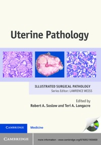 表紙画像: Uterine Pathology 1st edition 9780521509800