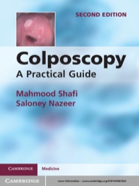 Titelbild: Colposcopy 2nd edition 9781107667822