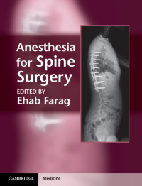 Cover image: Anesthesia for Spine Surgery 1st edition 9781107005310