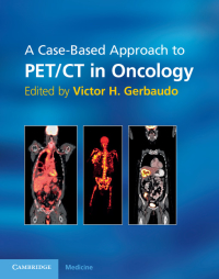 Imagen de portada: A Case-Based Approach to PET/CT in Oncology 1st edition 9780521116831