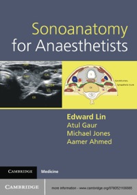 Cover image: Sonoanatomy for Anaesthetists 1st edition 9780521106665
