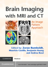 Cover image: Brain Imaging with MRI and CT 1st edition 9780521119443