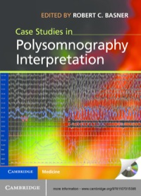 Cover image: Case Studies in Polysomnography Interpretation 1st edition 9781107015395