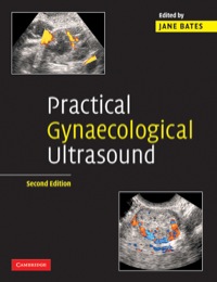 Imagen de portada: Practical Gynaecological Ultrasound 2nd edition 9780521674508