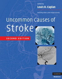 Cover image: Uncommon Causes of Stroke 2nd edition 9780521874373