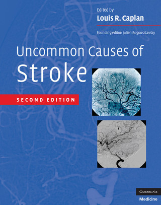 Imagen de portada: Uncommon Causes of Stroke 2nd edition 9780521874373