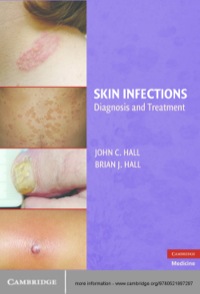 Cover image: Skin Infections 1st edition 9780521897297