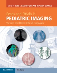 Titelbild: Pearls and Pitfalls in Pediatric Imaging 1st edition 9781107017498