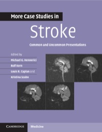Cover image: More Case Studies in Stroke 1st edition 9781107610033