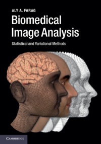 Titelbild: Biomedical Image Analysis 1st edition 9780521196796
