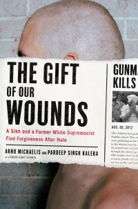 Cover image: The Gift of Our Wounds 9781250107541