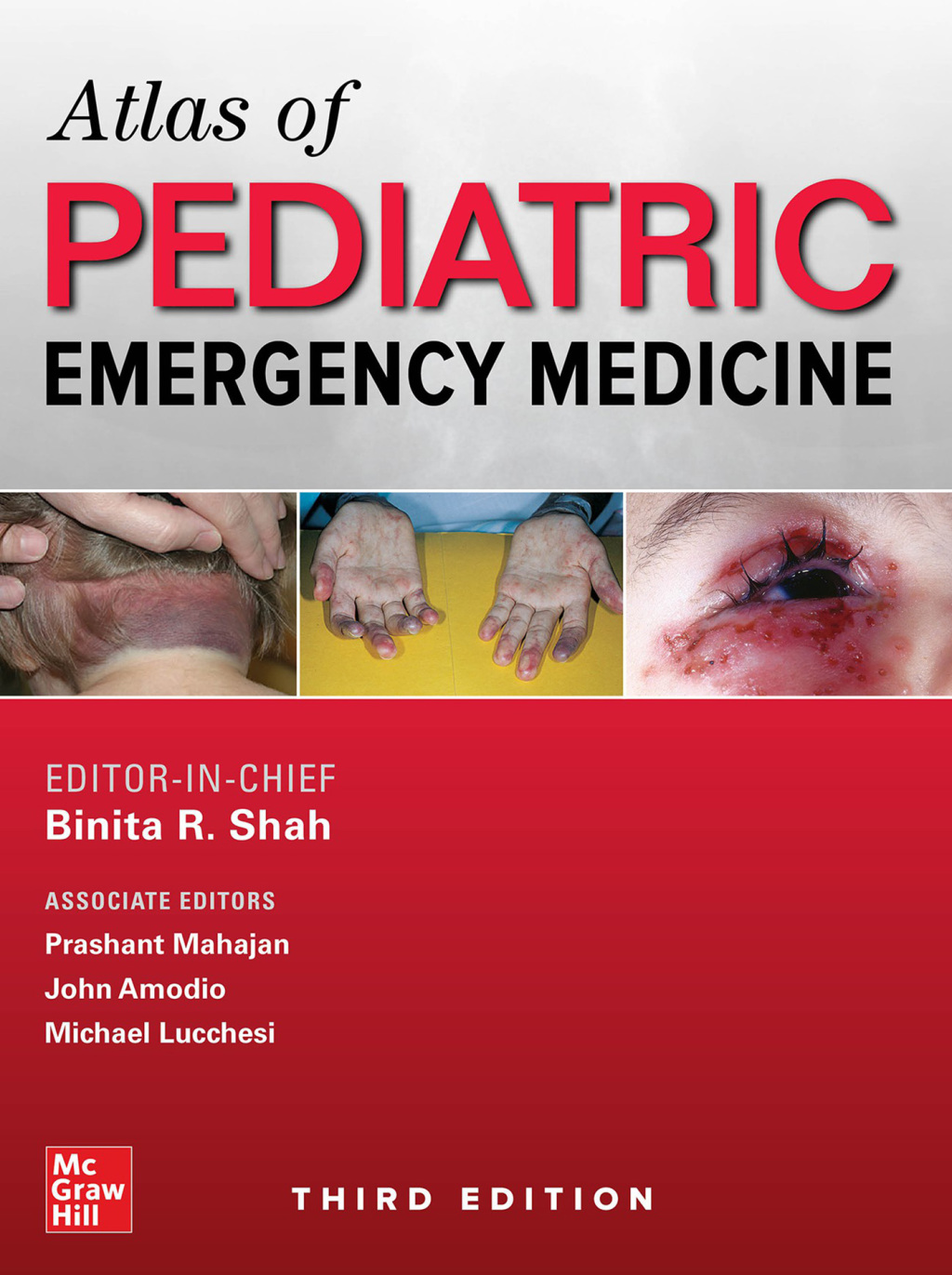 Atlas of Pediatric Emergency Medicine, Third Edition 3rd Edition