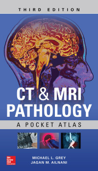 صورة الغلاف: CT & MRI Pathology: A Pocket Atlas 3rd edition 9781260121940