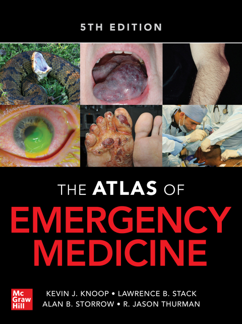 Atlas of Emergency Medicine, 5th Edition - FULL INSTANT DOWNLOAD | PDF DOCX EPUB
