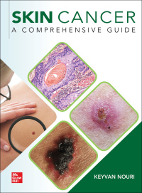 Cover image: Skin Cancer: A Comprehensive Guide 1st edition 9781260453003