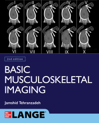 Titelbild: Basic Musculoskeletal Imaging, Second Edition 2nd edition 9781260459975