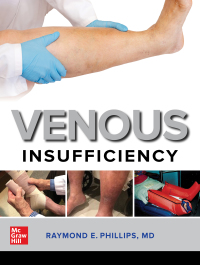 Cover image: Venous Insufficiency 1st edition 9781260461268