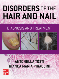 Cover image: Disorders of the Hair and Nail: Diagnosis and Treatment 1st edition 9781260462470