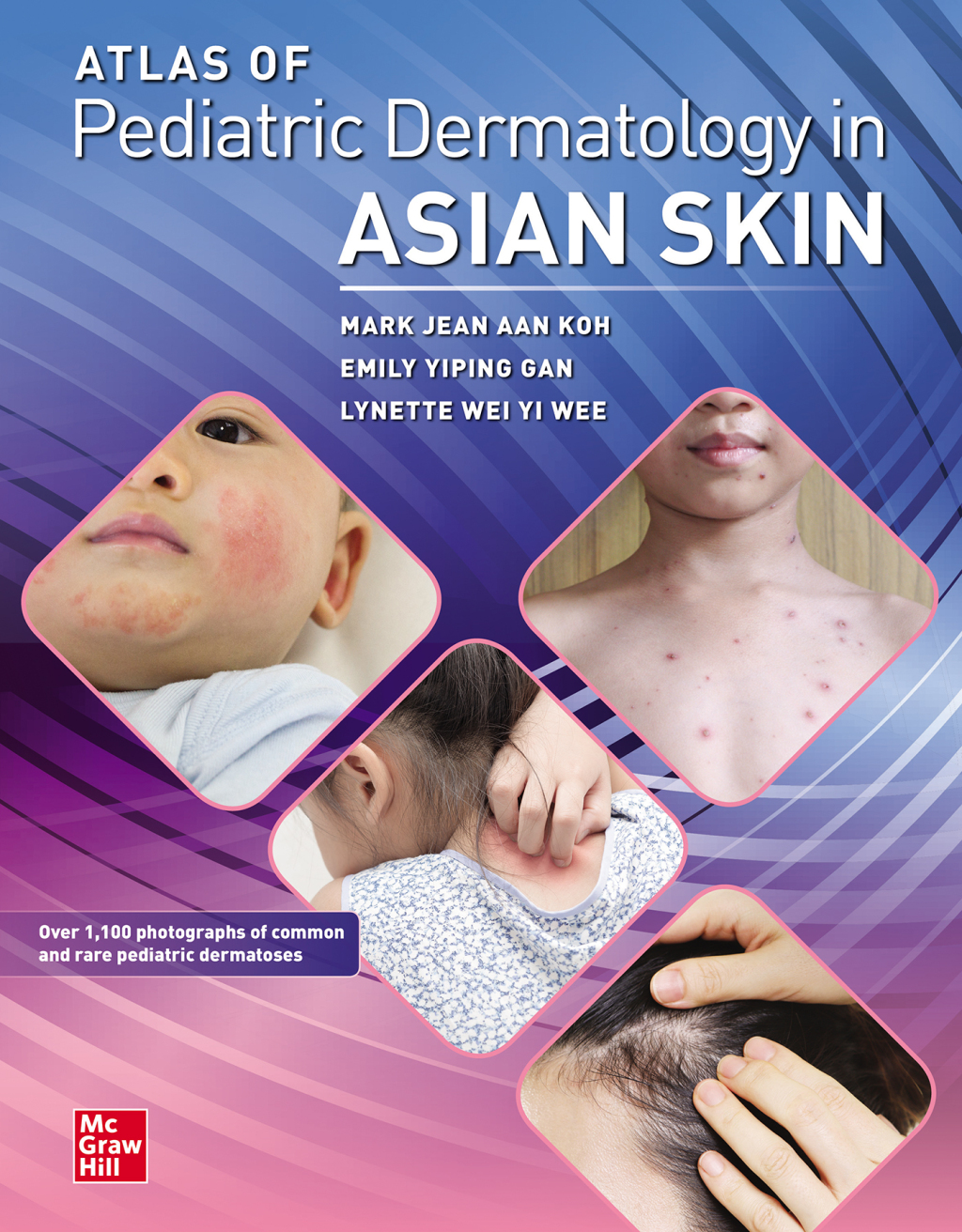 Atlas of Pediatric Dermatology in Asian Skin 1st Edition