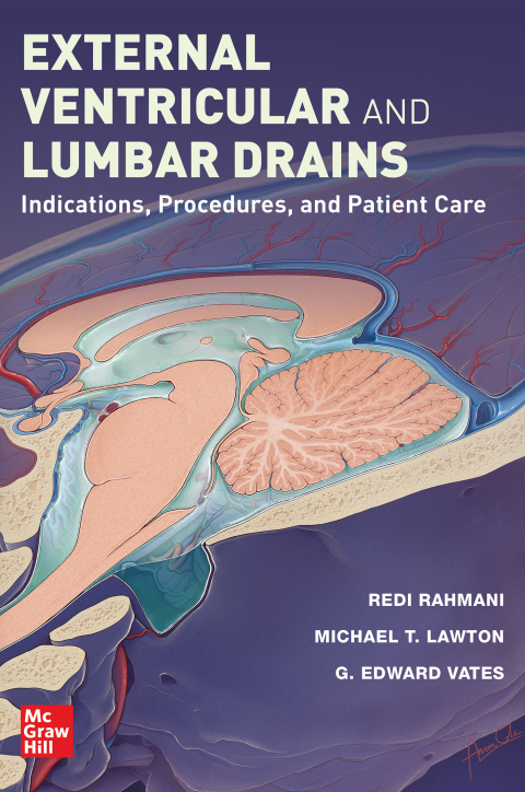 External Ventricular and Lumbar Drains: Indications, Procedures, and Patient Care, 1st Edition - FULL INSTANT DOWNLOAD | PDF DOCX EPUB