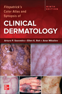 Imagen de portada: Fitzpatrick's Color Atlas and Synopsis of Clinical Dermatology 9th edition 9781264278015