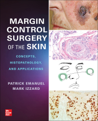 Imagen de portada: Margin Control Surgery of the Skin: Concepts, Histopathology, and Applications 1st edition 9781264285990