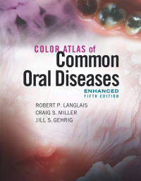 Titelbild: Color Atlas of Common Oral Diseases, Enhanced Edition 5th edition 9781284240986