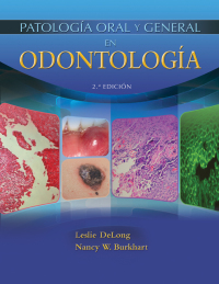 Cover image: Patología oral y general en odontología 2nd edition 9781284242072