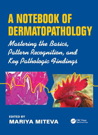 Cover image: A Notebook of Dermatopathology 1st edition 9781482219579